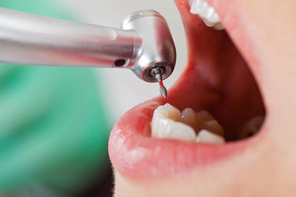 Best Emergency Gum Treatment in Seabrook Farms, NJ